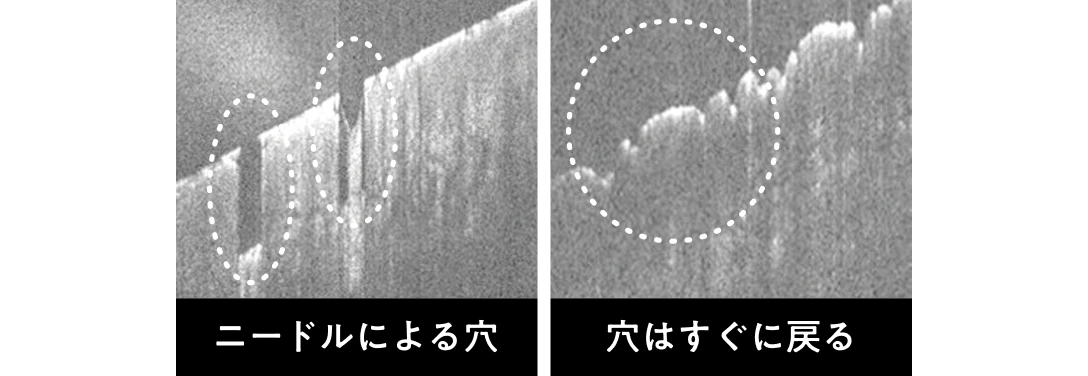 自然な修復機能